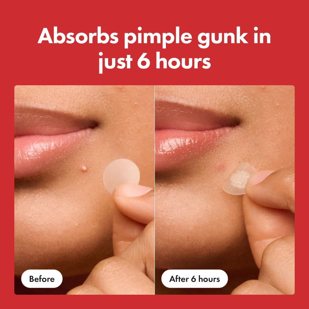 Hydrocolloid Acne Patches Invisible